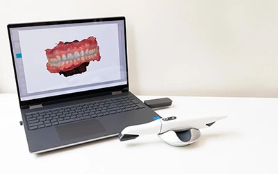 3D digital X-rays available at Berg Dental Group